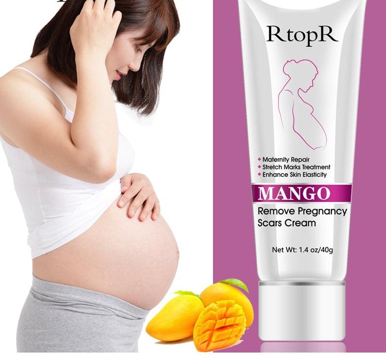 Mango Pregnancy Scars Remover - Stylus Kids