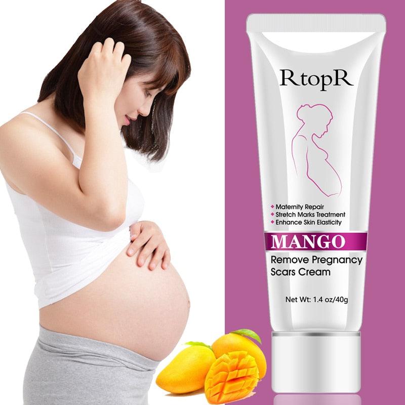 Mango Pregnancy Scars Remover - Stylus Kids